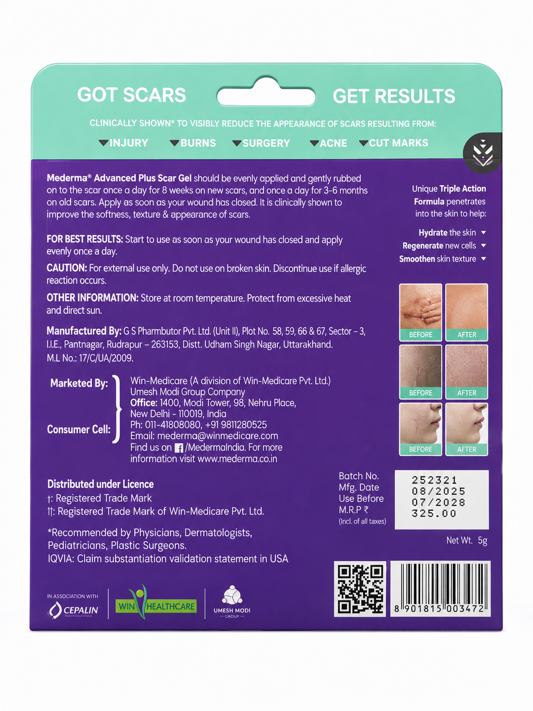 Mederma Advanced Plus Scar Gel – Scar Reduction Gel for Old & New Scars, Acne Marks, Surgery Scars, Burns & Cut Marks, Lightweight Daily Scar Care Formula, 5g